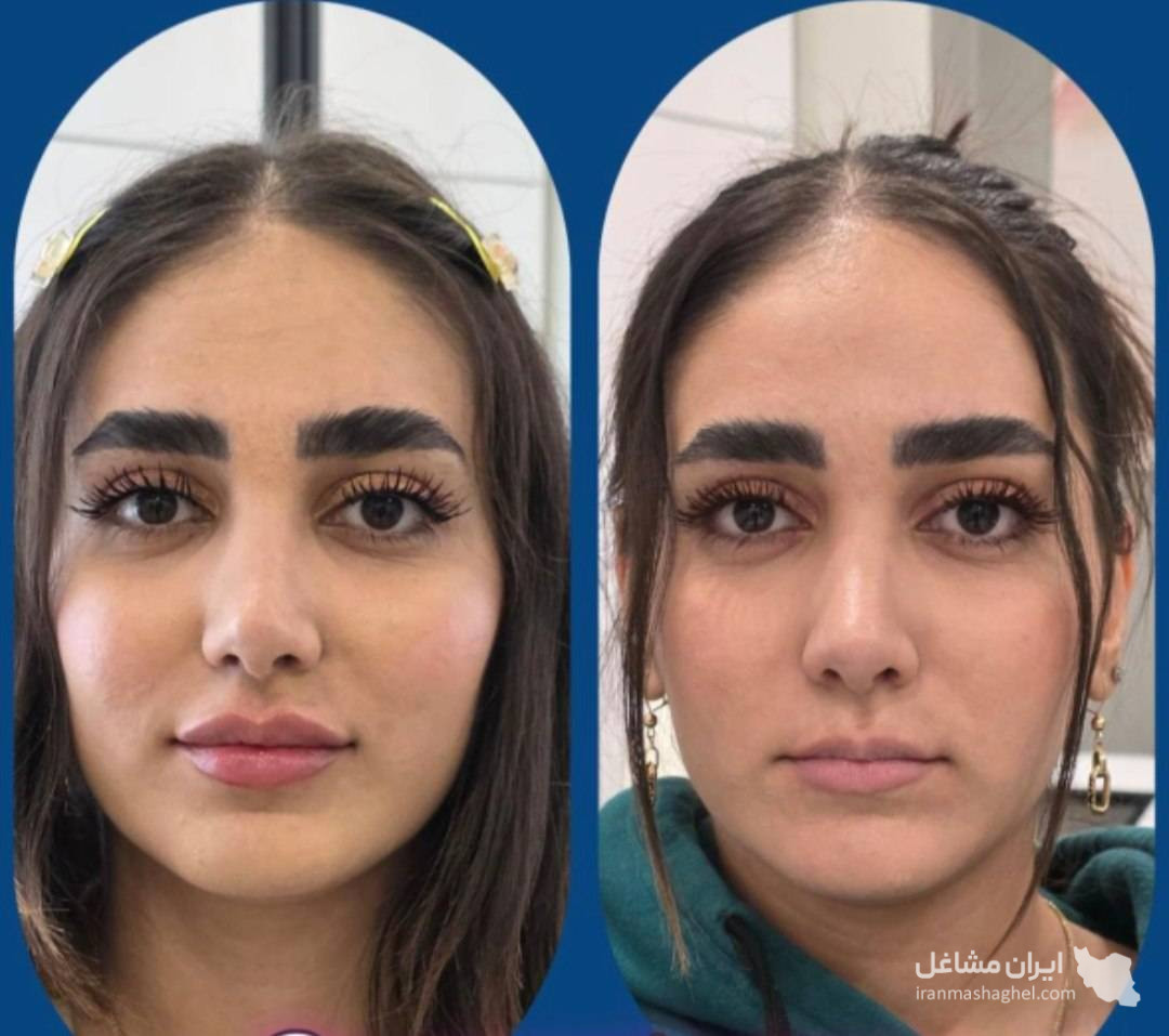 کلینیک زیبایی پوست و مو و لیزر هامین در شیراز
