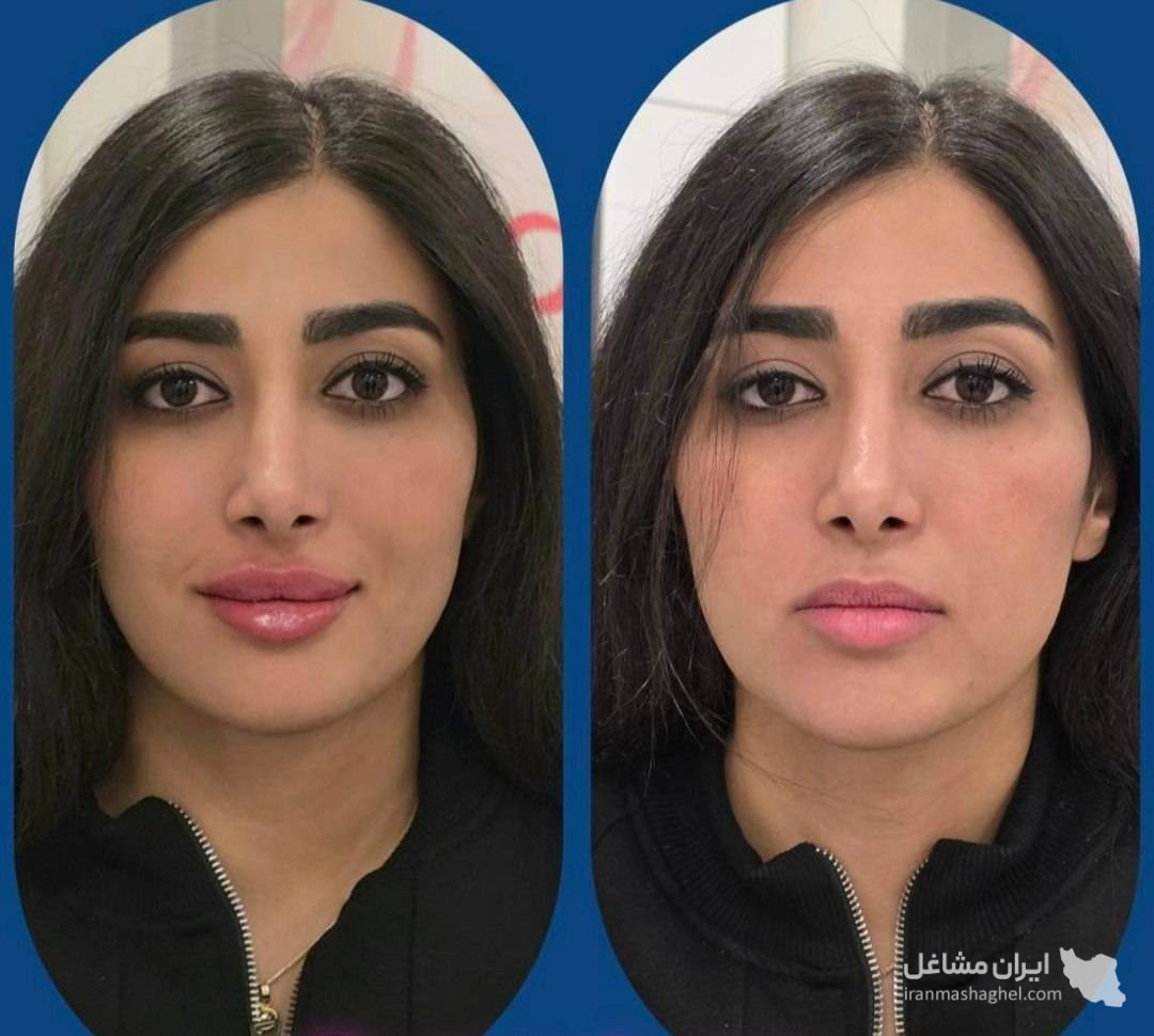 کلینیک زیبایی پوست و مو و لیزر هامین در شیراز