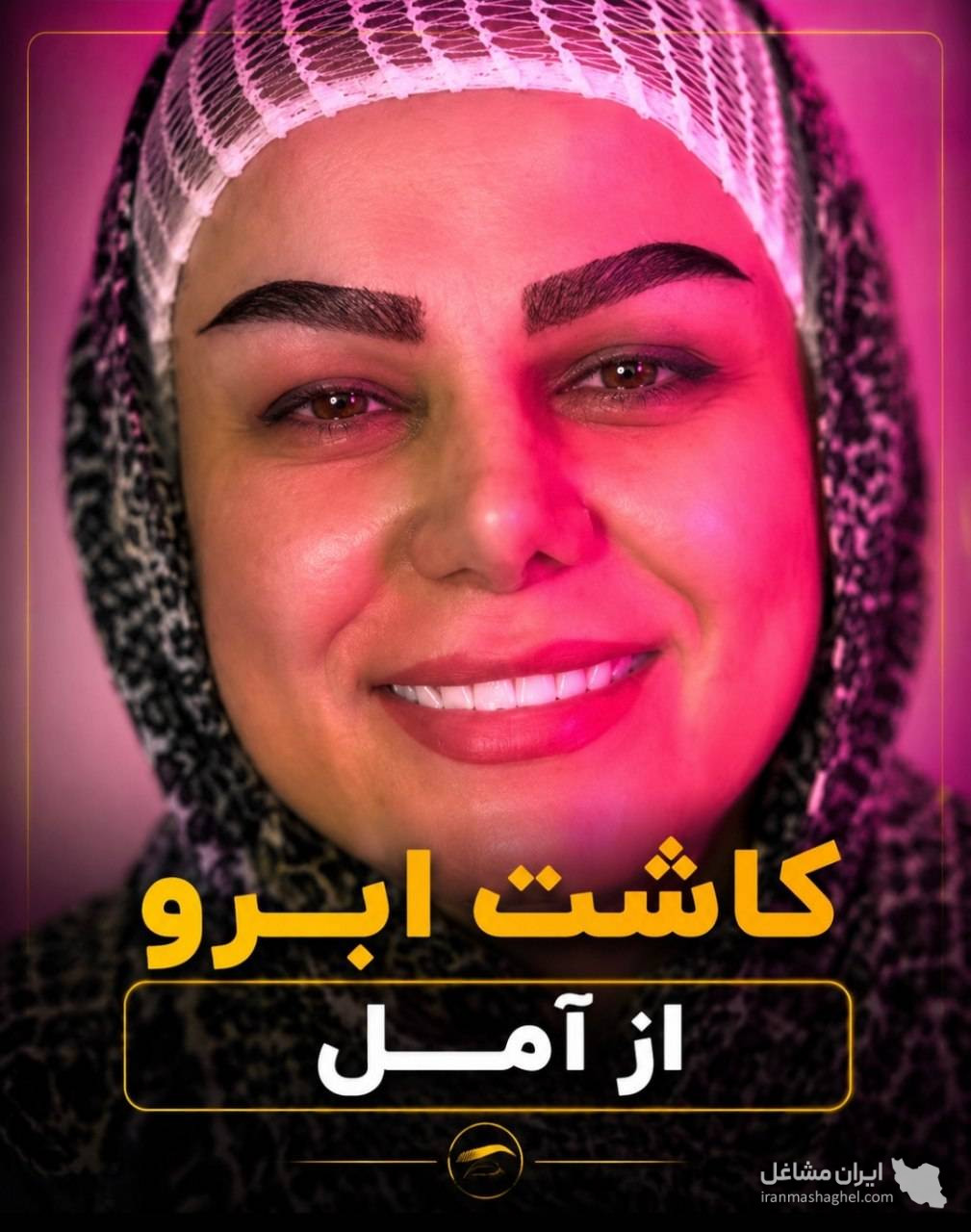 کلینیک تخصصی کاشت مو و ابرو ماهتیسا در بابل