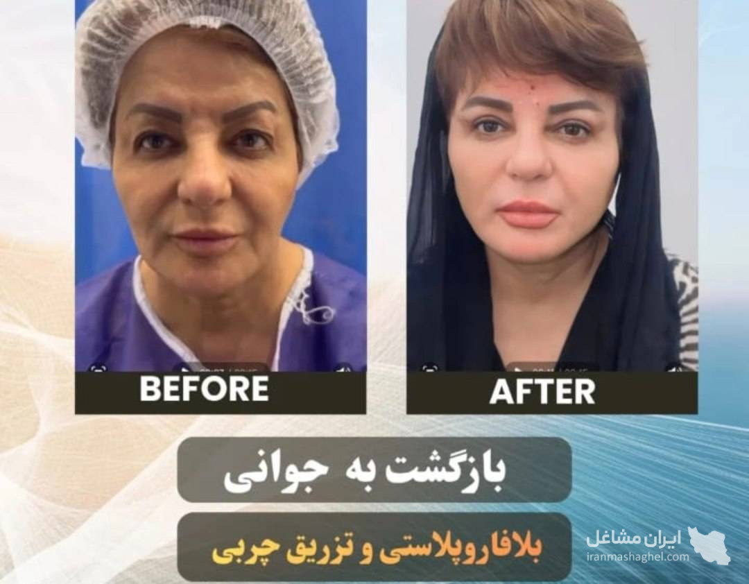 مرکز تخصصی بلفارو پلاستی و سانترال دکتر وحید عباس نژاد در صادقیه تهران