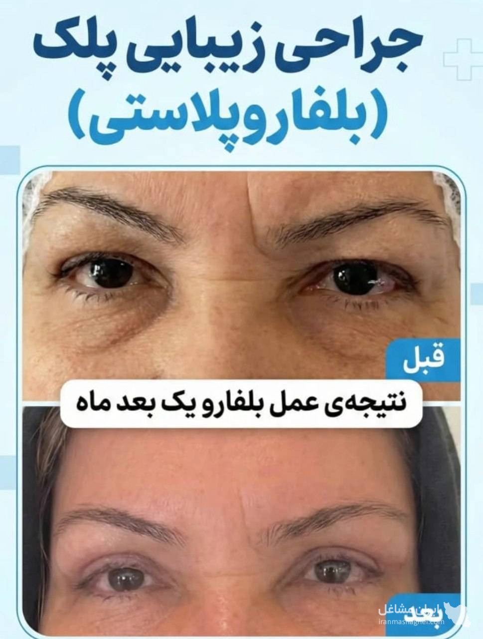 مرکز تخصصی بلفارو پلاستی و سانترال دکتر وحید عباس نژاد در صادقیه تهران