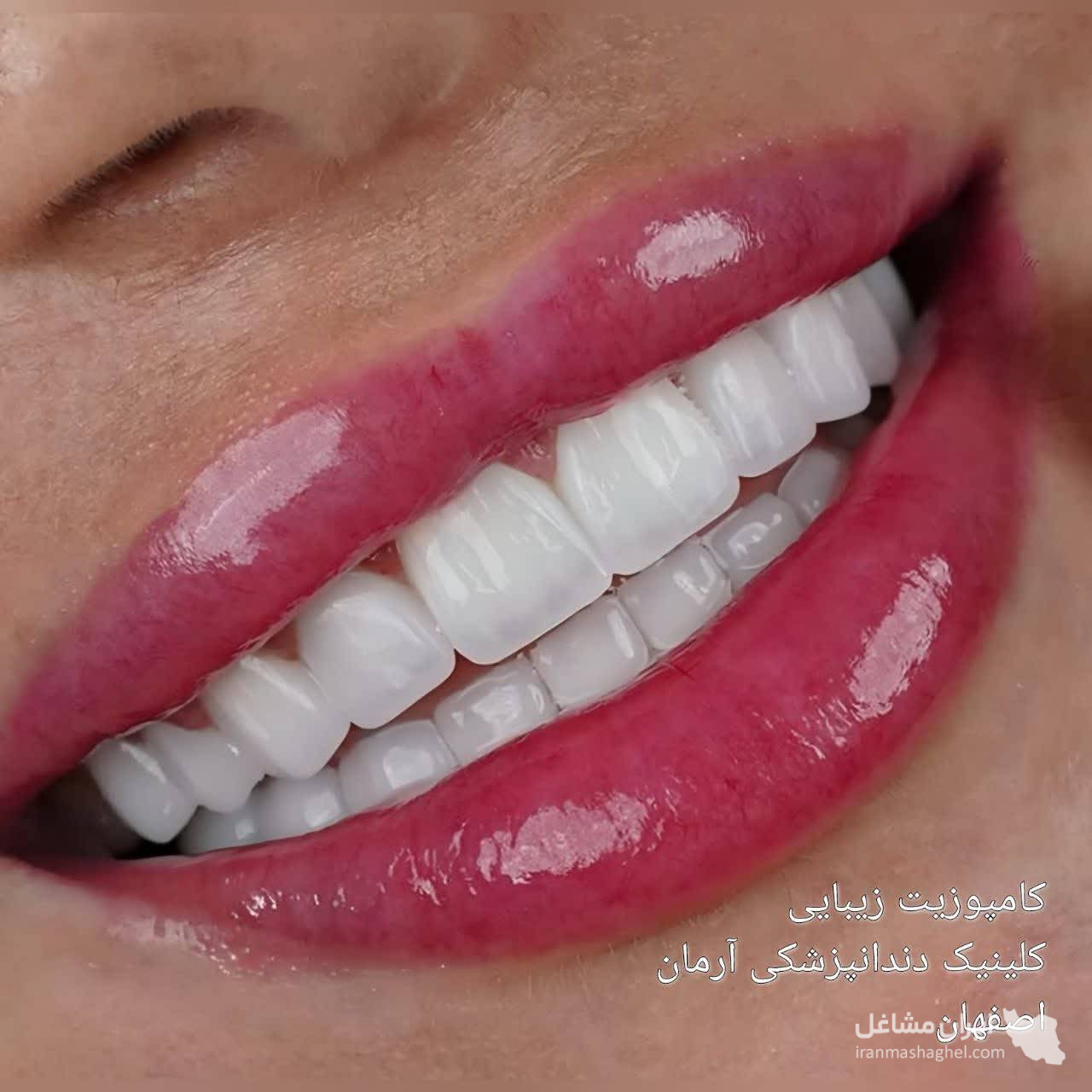 کلینیک کامپوزیت و لمینت دندان آرمان دکتر صفاری در اصفهان