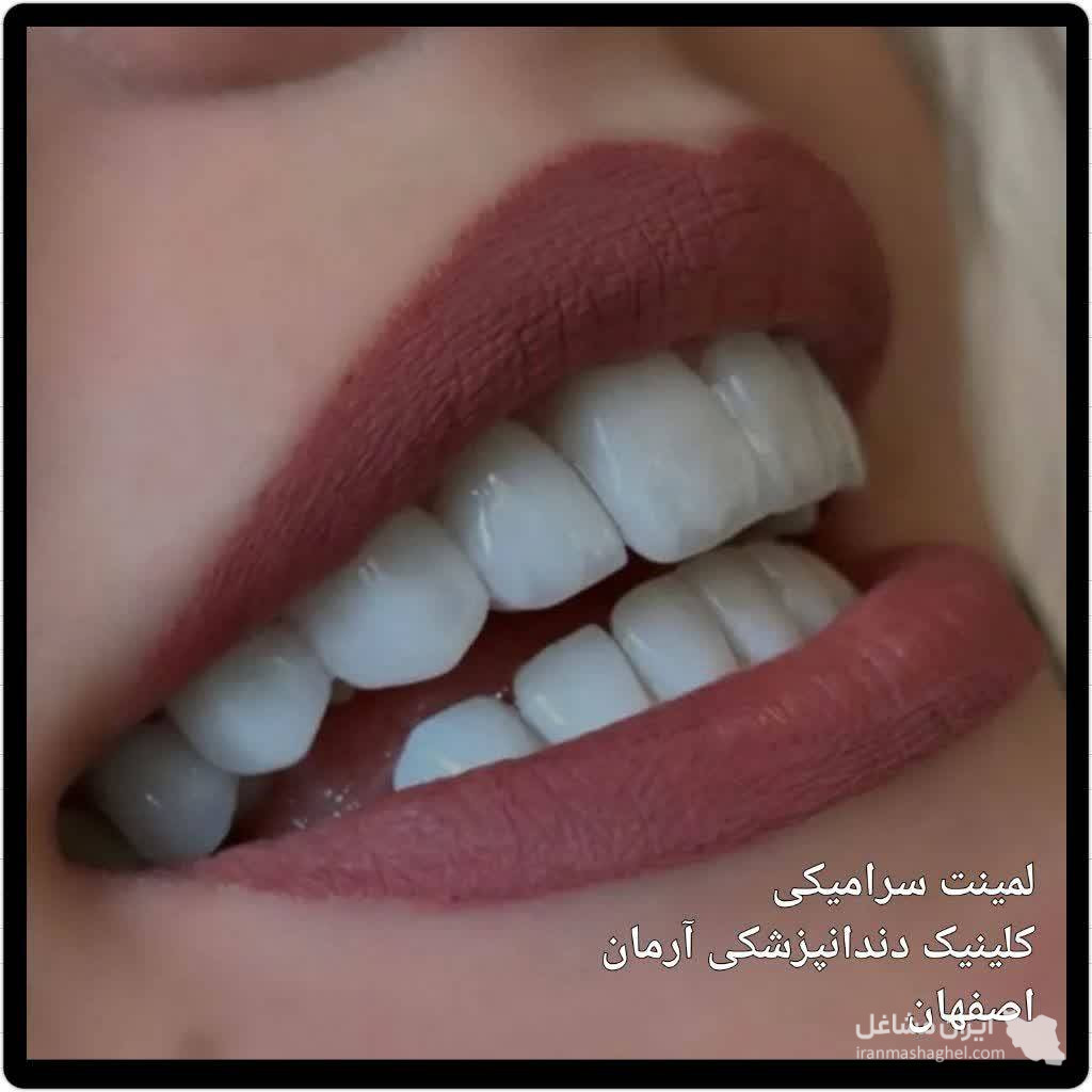 کلینیک کامپوزیت و لمینت دندان آرمان دکتر صفاری در اصفهان