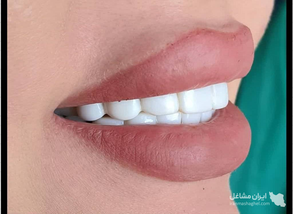 کلینیک کامپوزیت و لمینت دندان آرمان دکتر صفاری در اصفهان