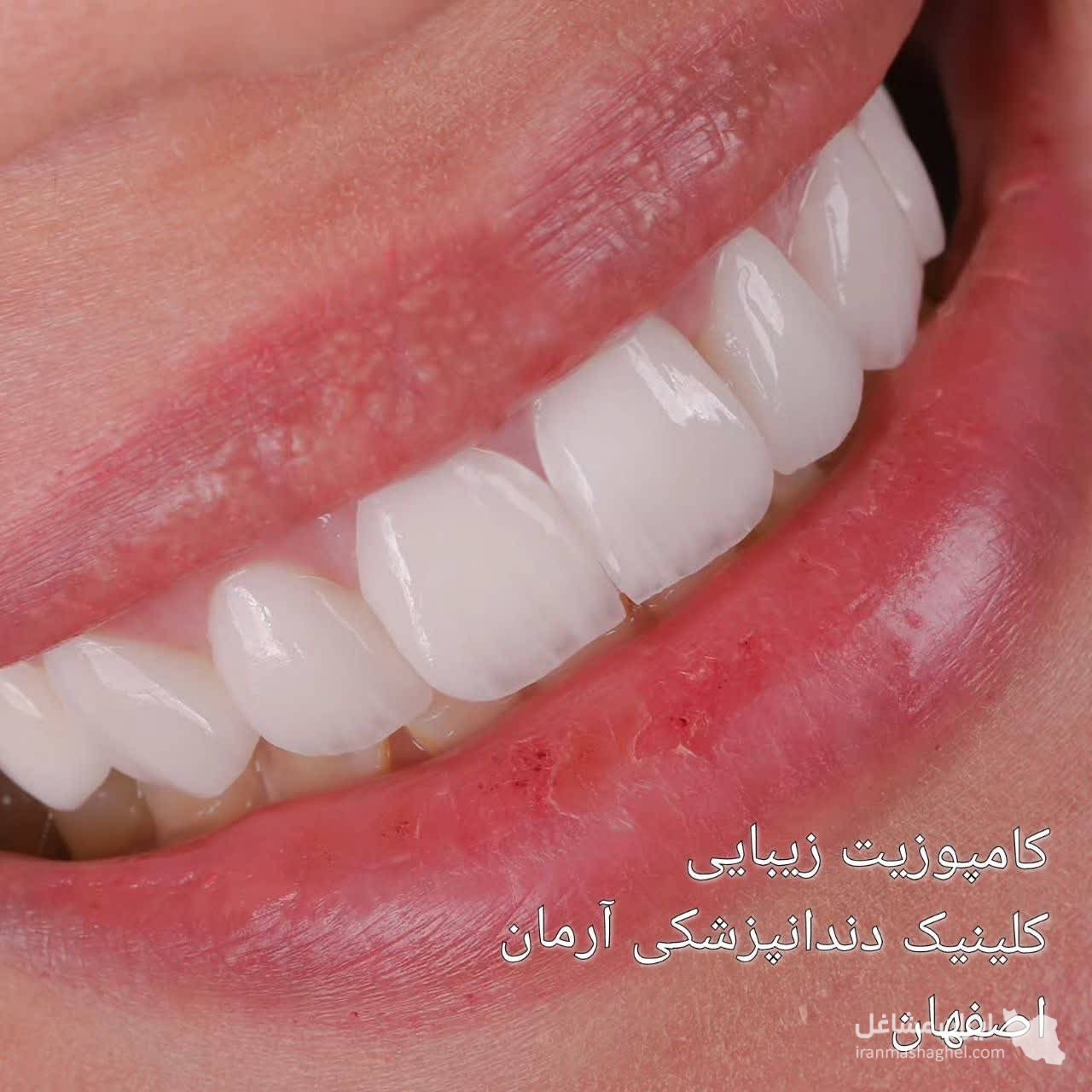 کلینیک کامپوزیت و لمینت دندان آرمان دکتر صفاری در اصفهان