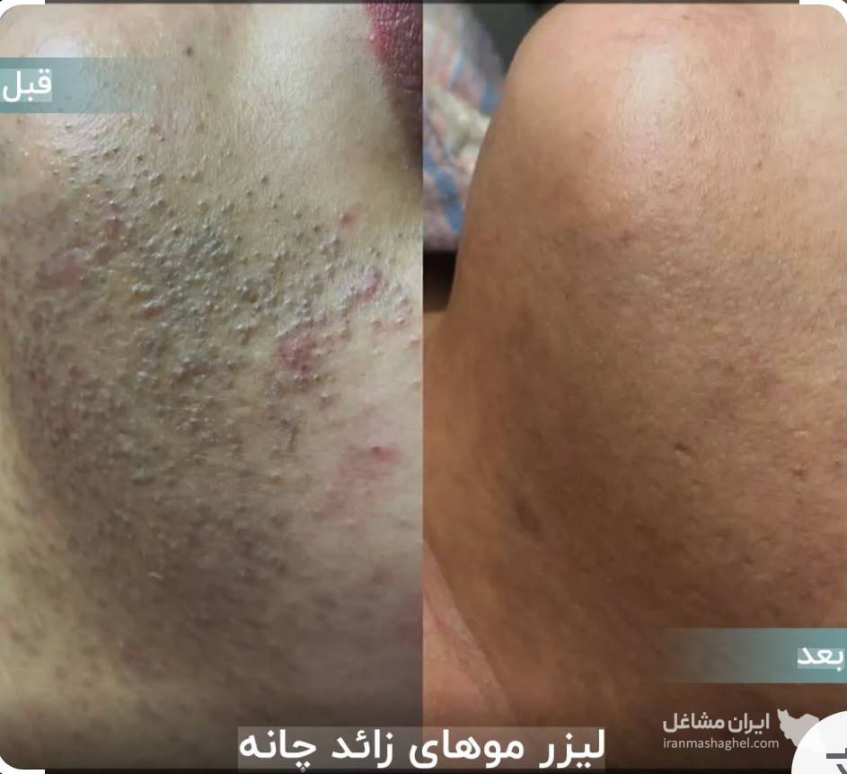مرکز تخصصی لیزر نایس خانم قاعدی در رفسنجان