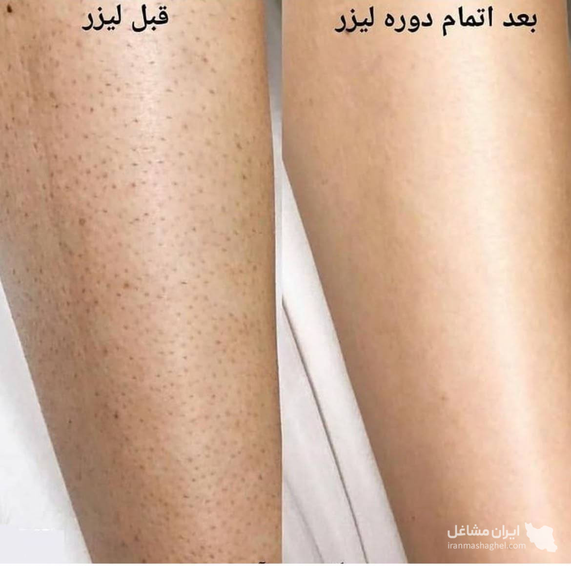 مرکز تخصصی لیزر نایس خانم قاعدی در رفسنجان