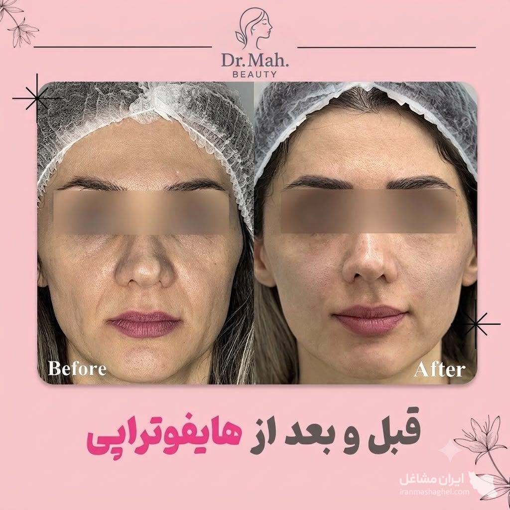 کلینیک زیبایی مه بیوتی دکتر فاطمه مشیری در قائمشهر