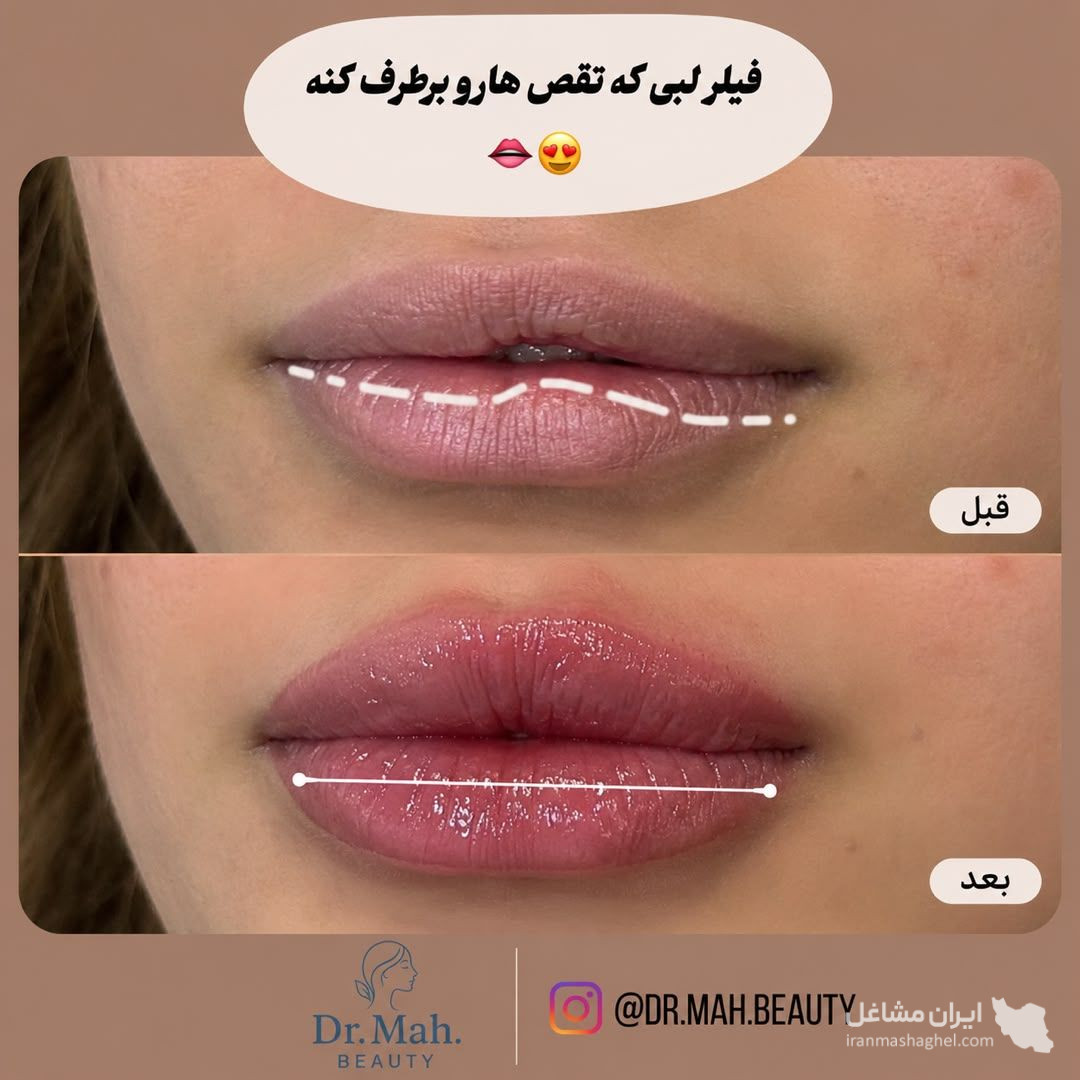 کلینیک زیبایی مه بیوتی دکتر فاطمه مشیری در قائمشهر