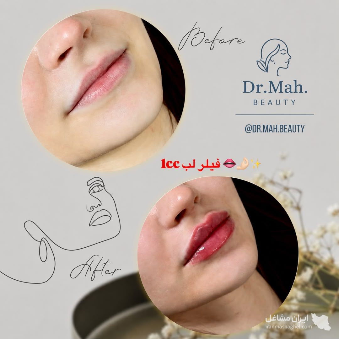 کلینیک زیبایی مه بیوتی دکتر فاطمه مشیری در قائمشهر