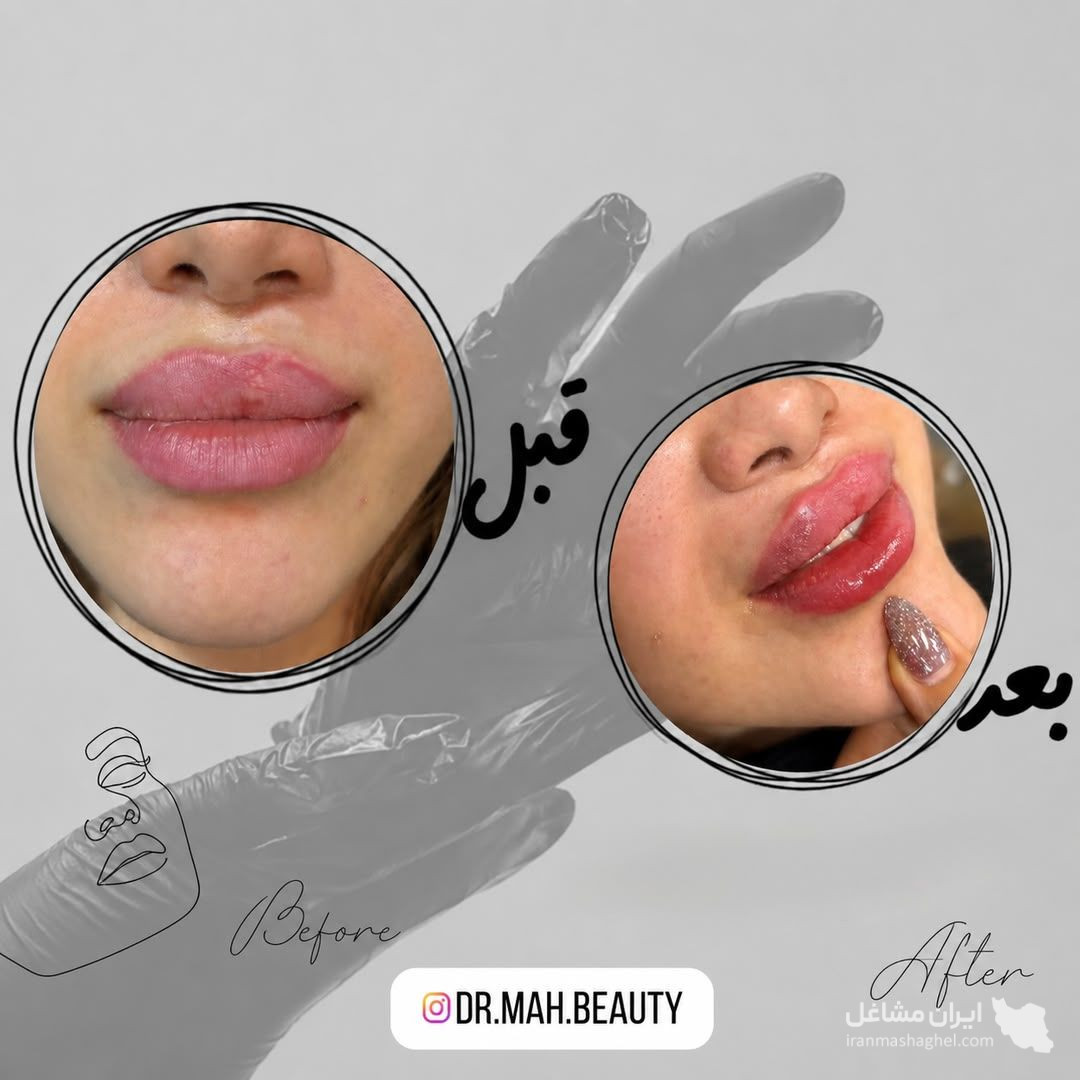 کلینیک زیبایی مه بیوتی دکتر فاطمه مشیری در قائمشهر