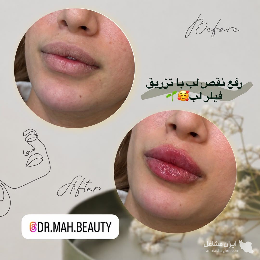 کلینیک زیبایی مه بیوتی دکتر فاطمه مشیری در قائمشهر