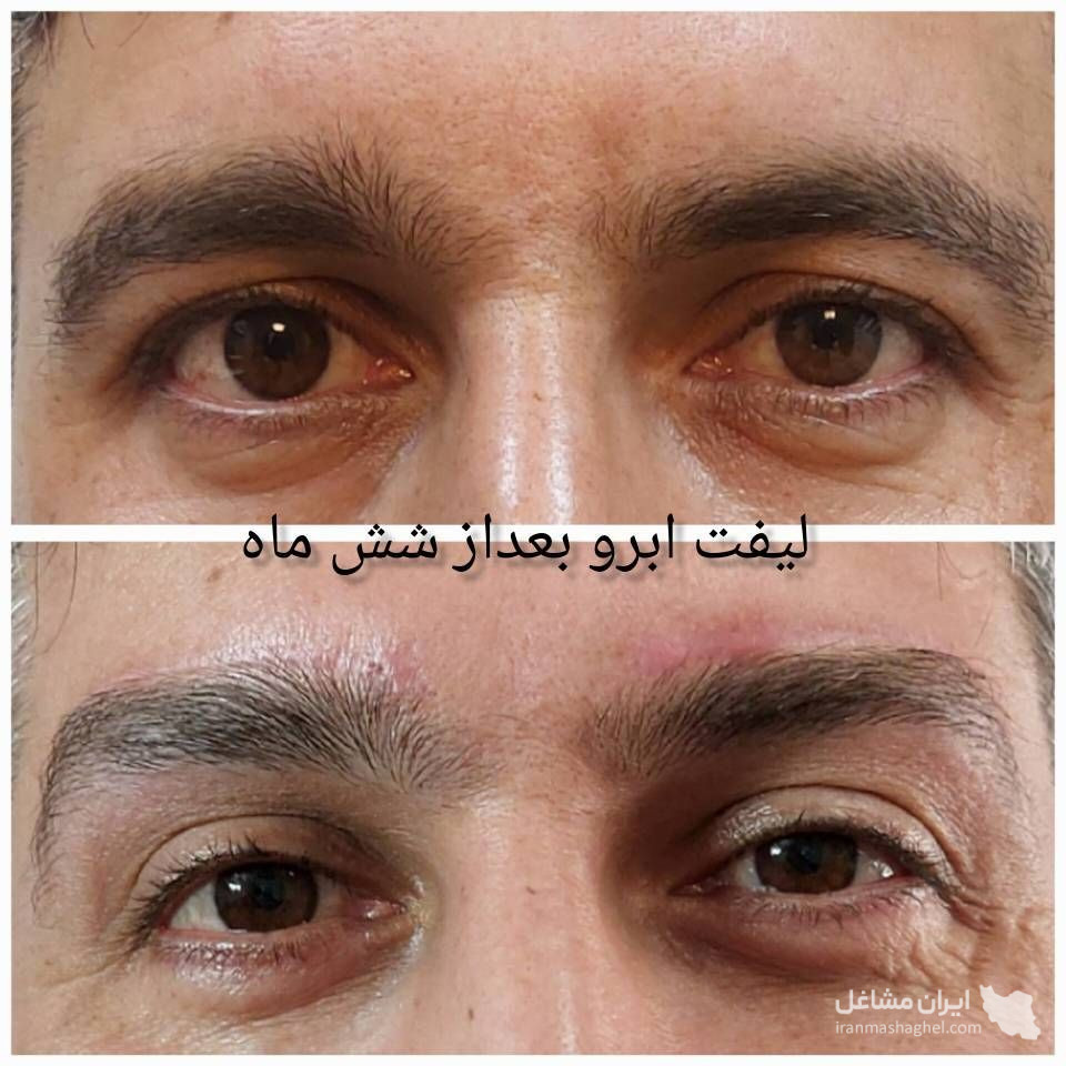 مرکز بلفاروپلاستی پلک بالا و پایین دکتر فرشته شاد در پیروزی تهران