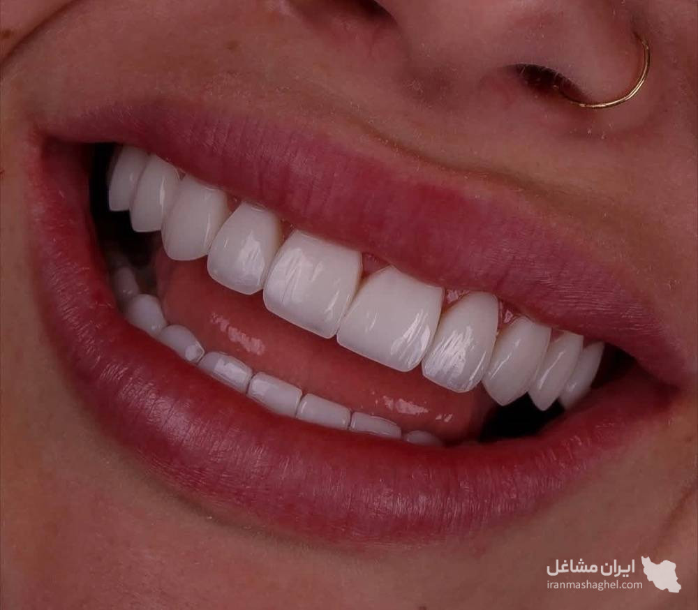 دندانسازی زارعی در یزد