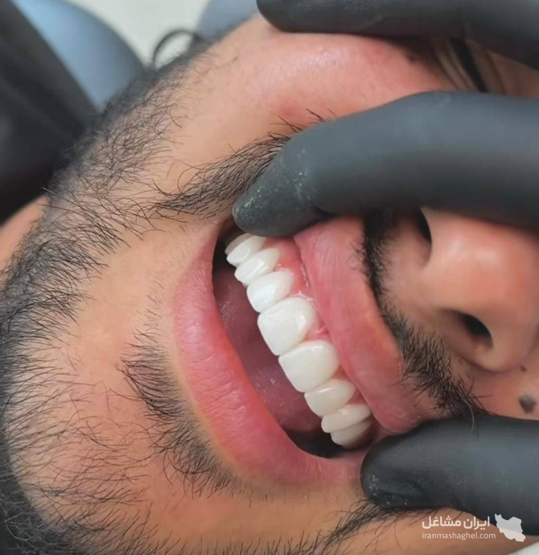 دندانسازی زارعی در یزد