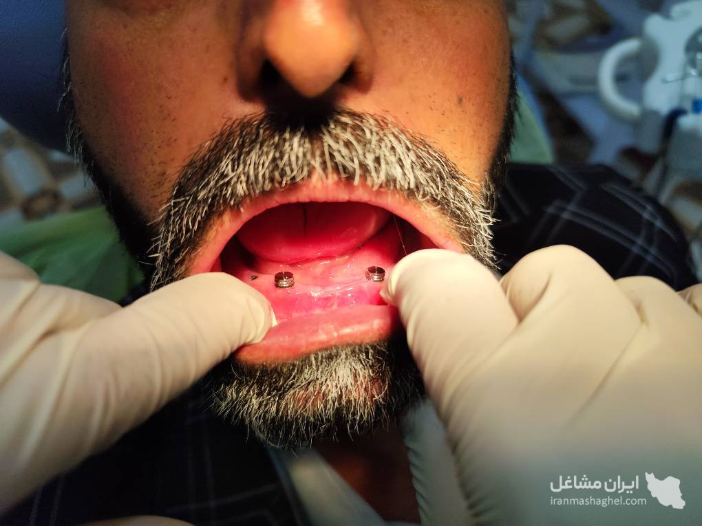 دندانسازی زارعی در یزد