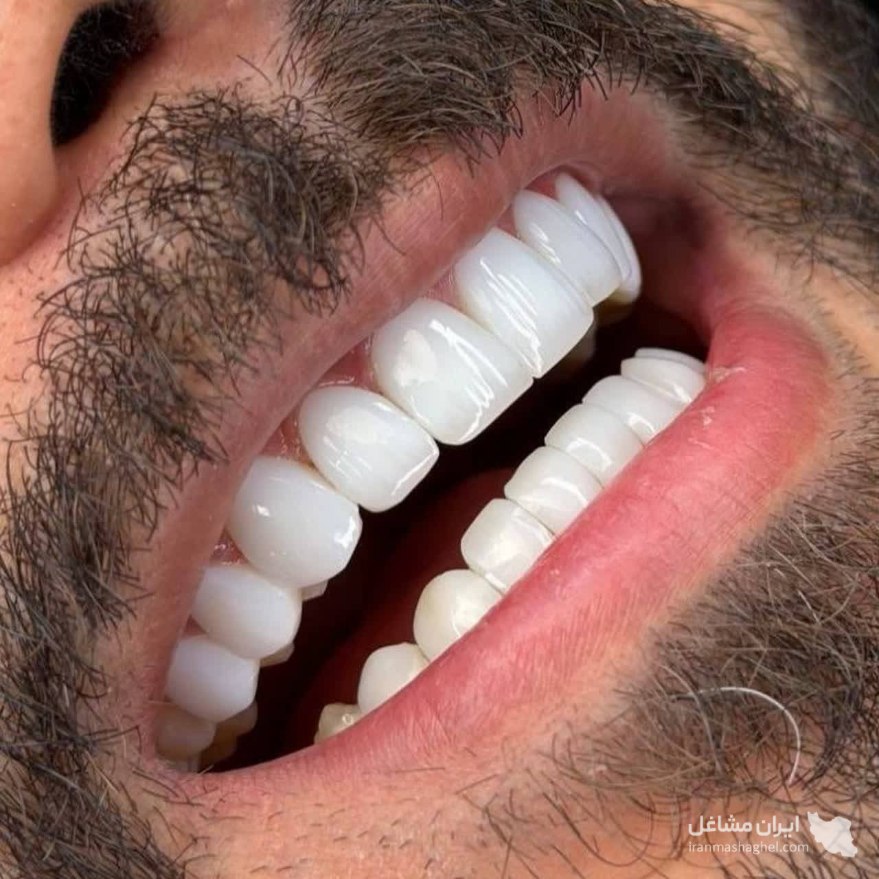 دندانسازی زارعی در یزد