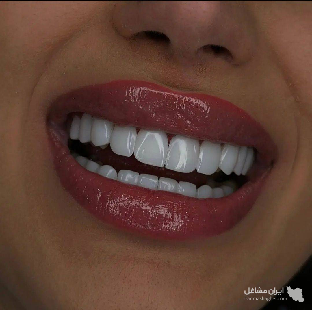 دندانسازی زارعی در یزد