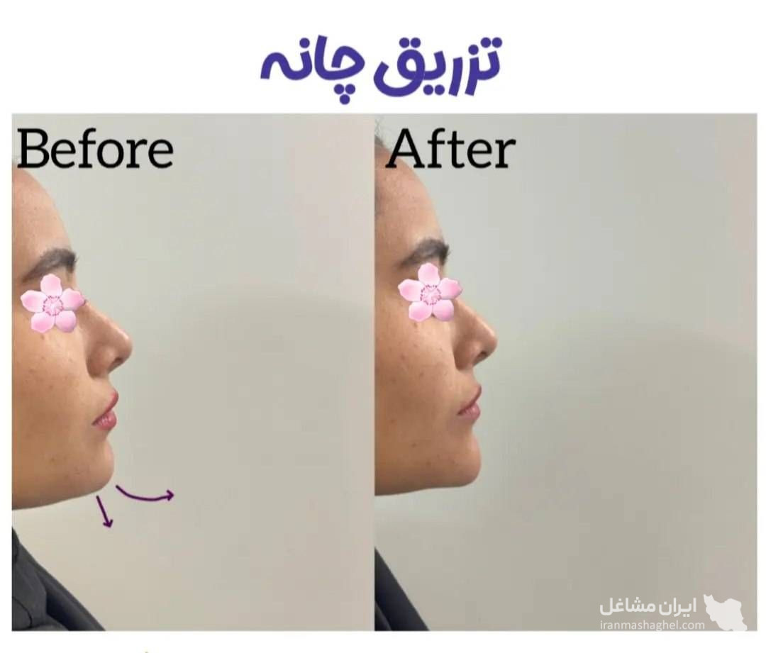 کلینیک زیبایی پوست و مو آلن دکتر احسان بابایی در یزد