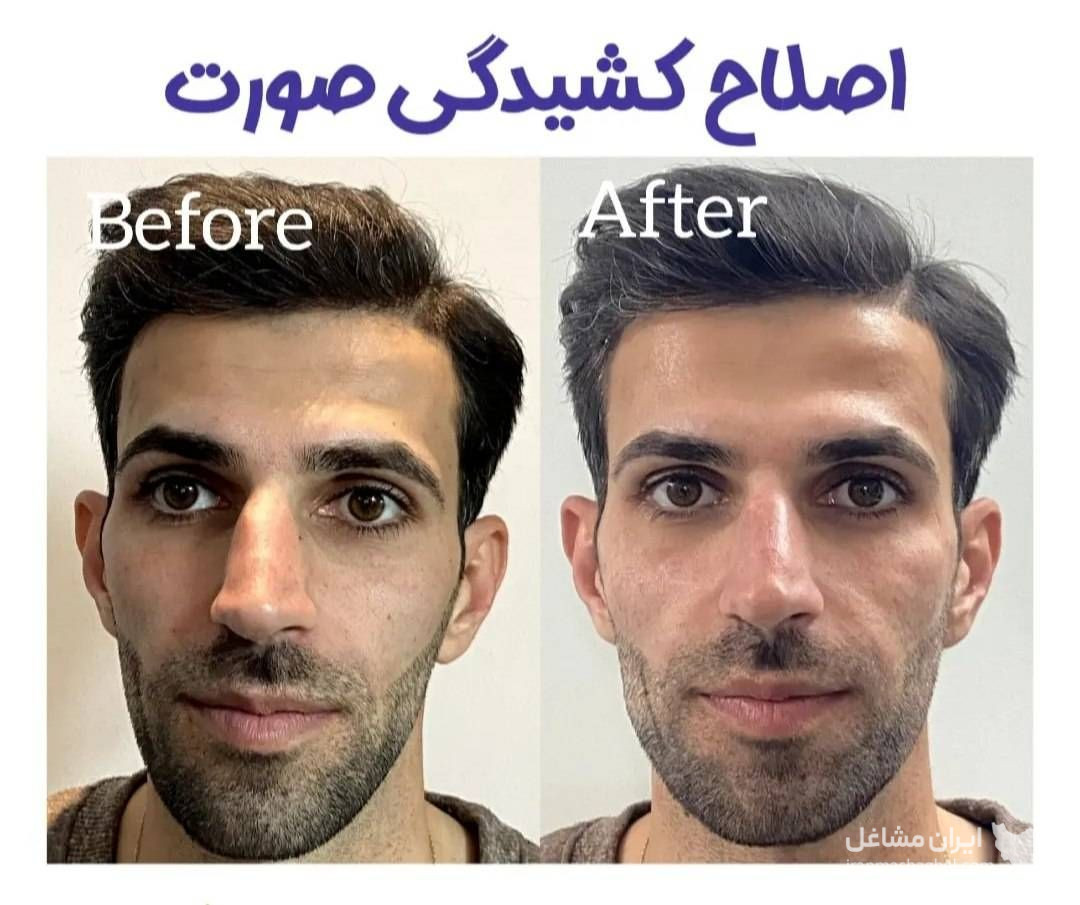 کلینیک زیبایی پوست و مو آلن دکتر احسان بابایی در یزد