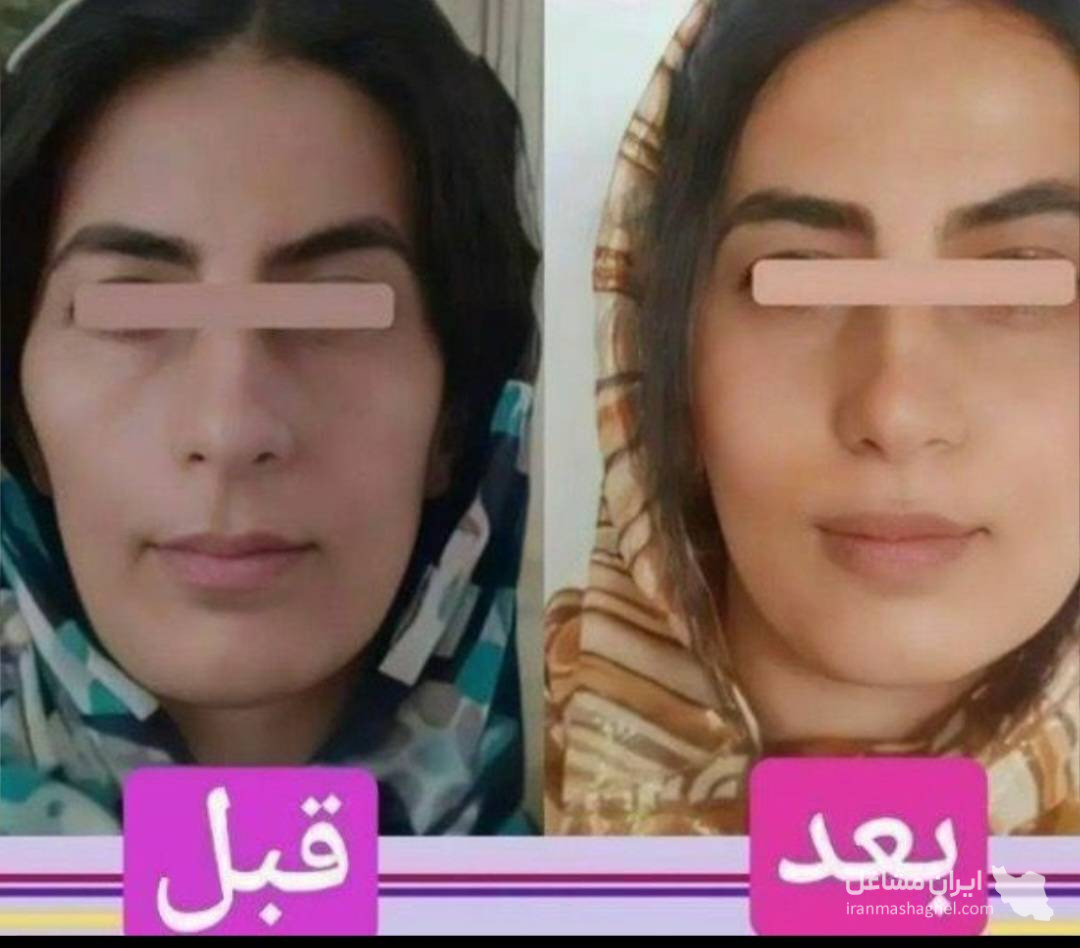 فروش پودر جوانه گندم برای چاقی صورت به مدیریت رحمانی در مشهد