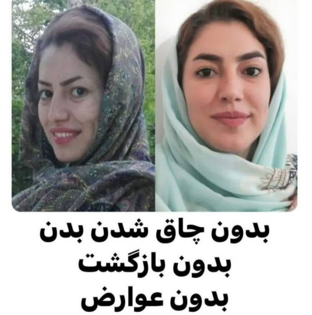 فروش پودر جوانه گندم برای چاقی صورت به مدیریت رحمانی در قم