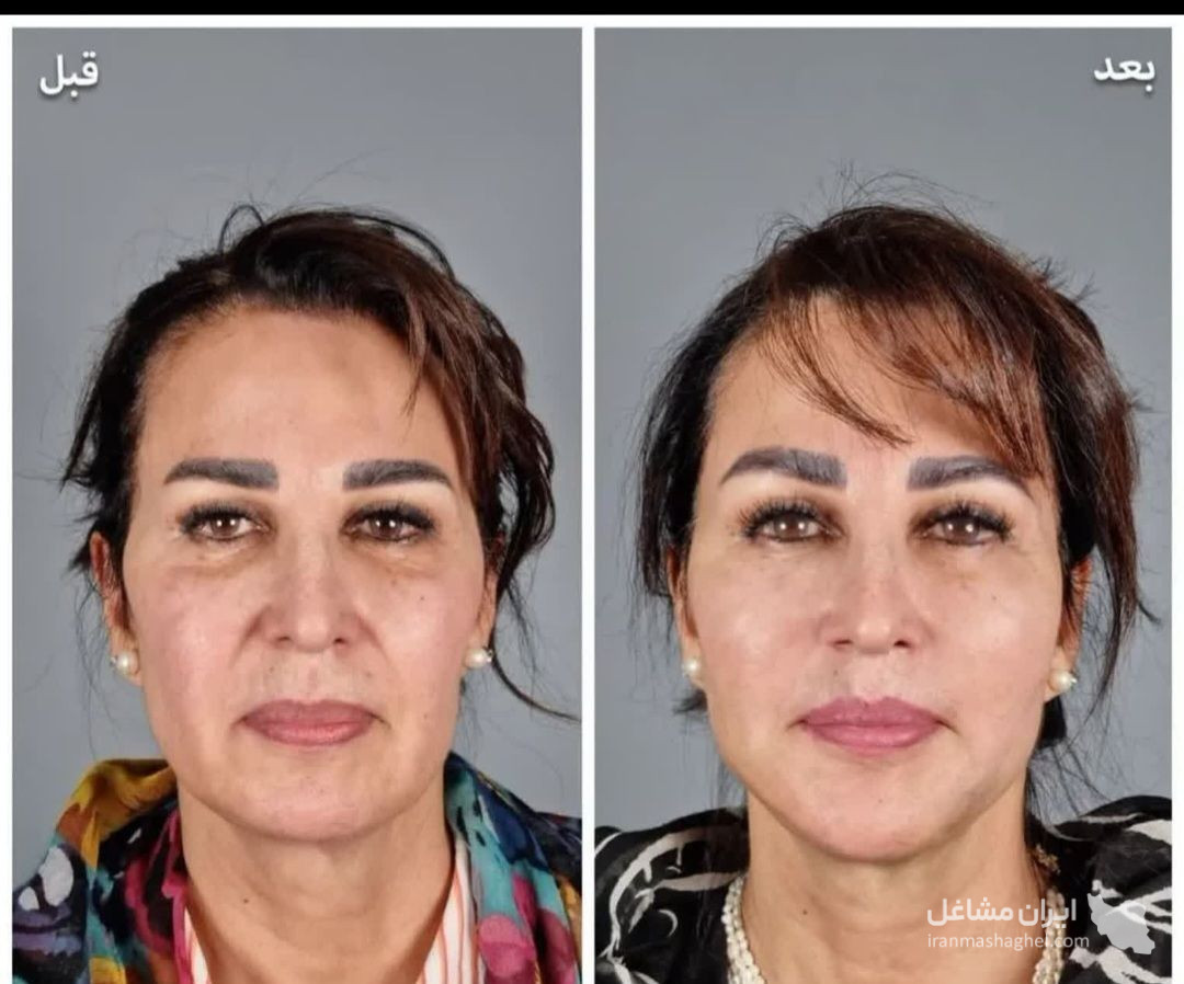 فروش پودر جوانه گندم برای چاقی صورت به مدیریت رحمانی در کرج