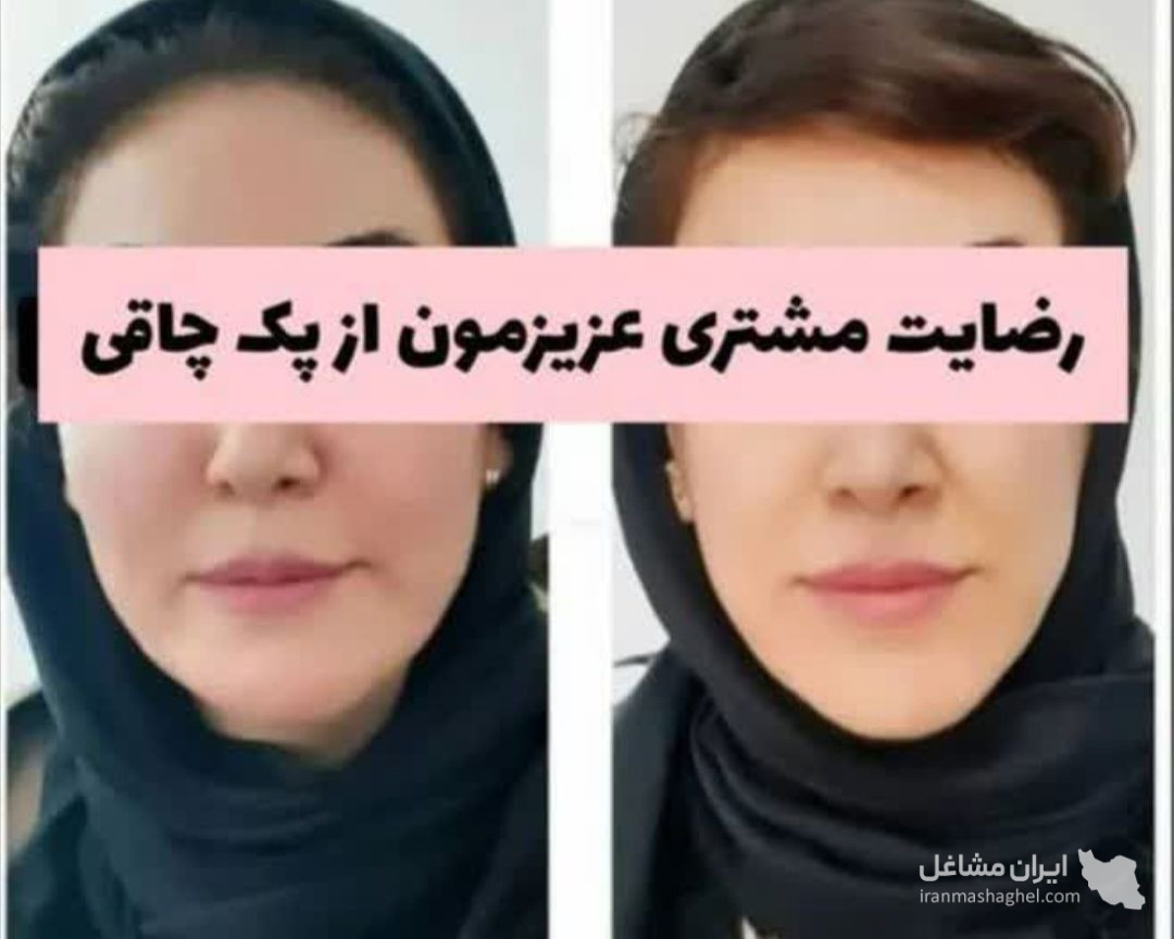 فروش پودر جوانه گندم برای چاقی صورت به مدیریت رحمانی در تبریز