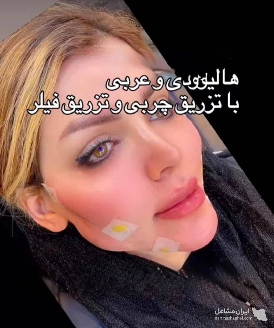 مرکز تخصصی تزریق چربی دکتر وحید عباس نژاد در صادقیه تهران