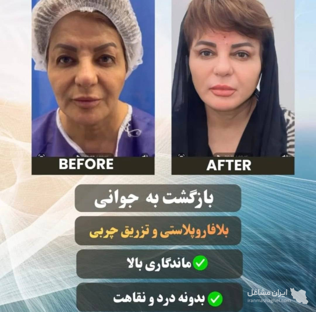 مرکز تخصصی تزریق چربی دکتر وحید عباس نژاد در صادقیه تهران