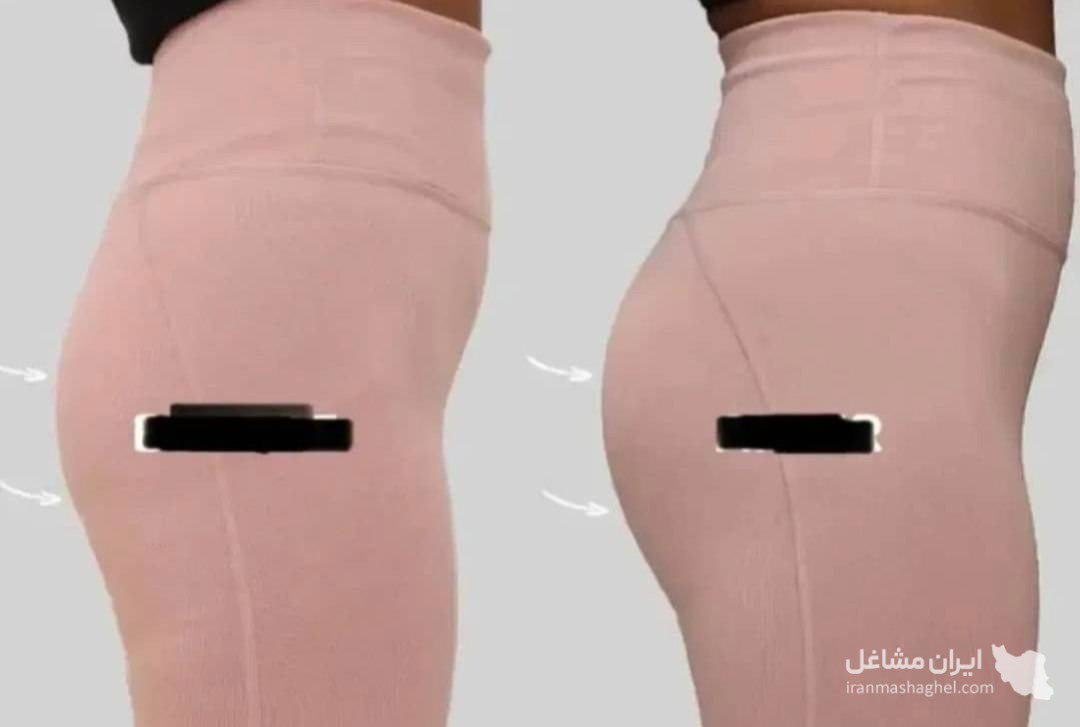 مرکز تخصصی فیلر بادی و باسن دکتر وحید عباس نژاد در صادقیه تهران