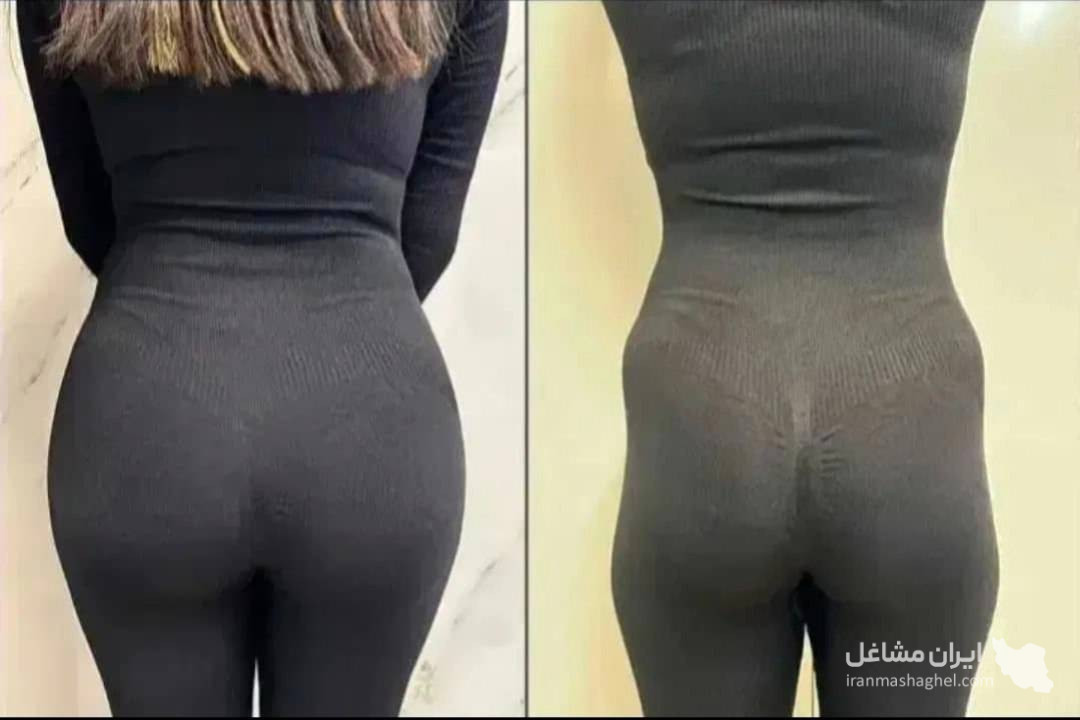 مرکز تخصصی فیلر بادی و باسن دکتر وحید عباس نژاد در صادقیه تهران