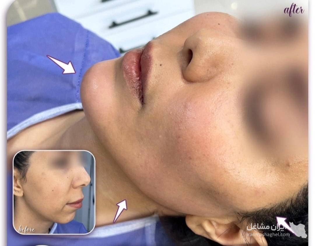 مرکز تخصصی ساکشن غبغب و بوکال فت دکتر وحید عباس نژاد در صادقیه تهران