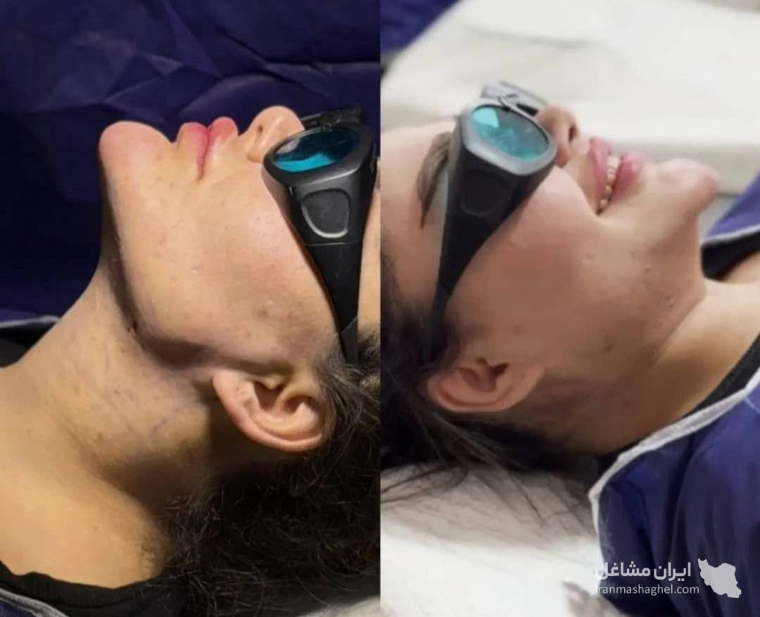 مرکز تخصصی ساکشن غبغب و بوکال فت دکتر وحید عباس نژاد در صادقیه تهران