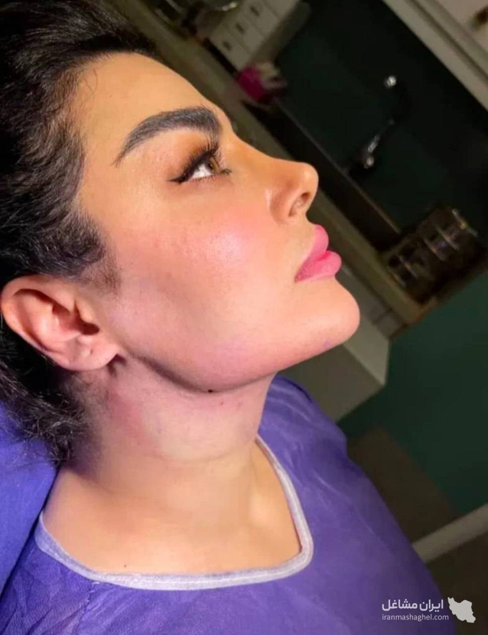 مرکز تخصصی ساکشن غبغب و بوکال فت دکتر وحید عباس نژاد در صادقیه تهران