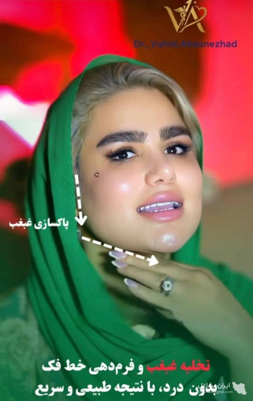 مرکز تخصصی ساکشن غبغب و بوکال فت دکتر وحید عباس نژاد در صادقیه تهران