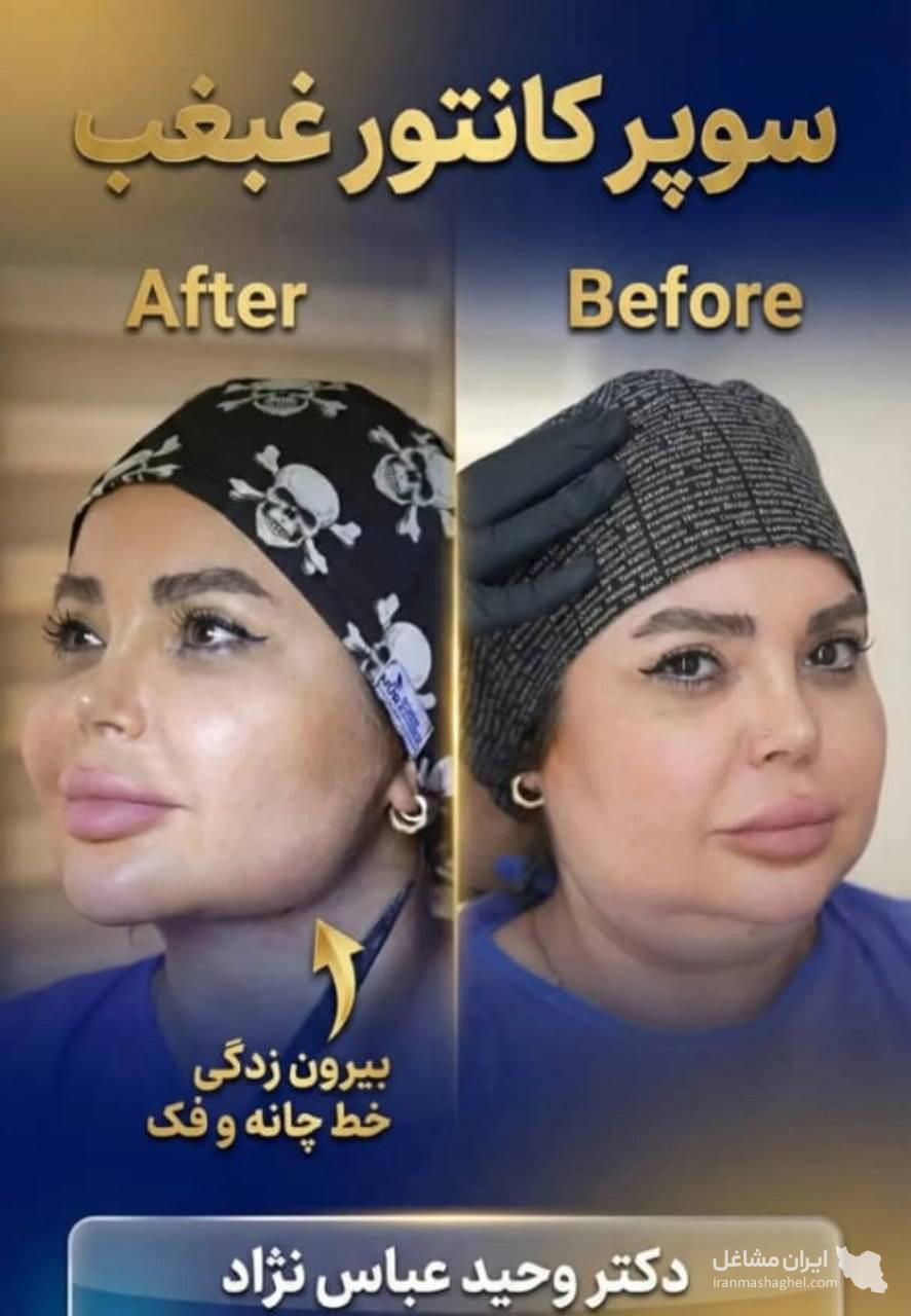 مرکز تخصصی ساکشن غبغب و بوکال فت دکتر وحید عباس نژاد در صادقیه تهران