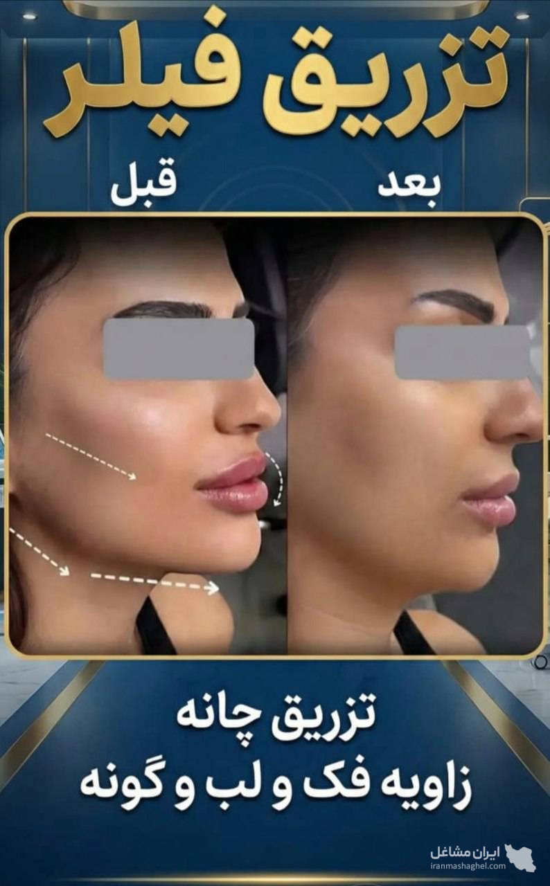 مرکز تخصصی ساکشن غبغب و بوکال فت دکتر وحید عباس نژاد در صادقیه تهران