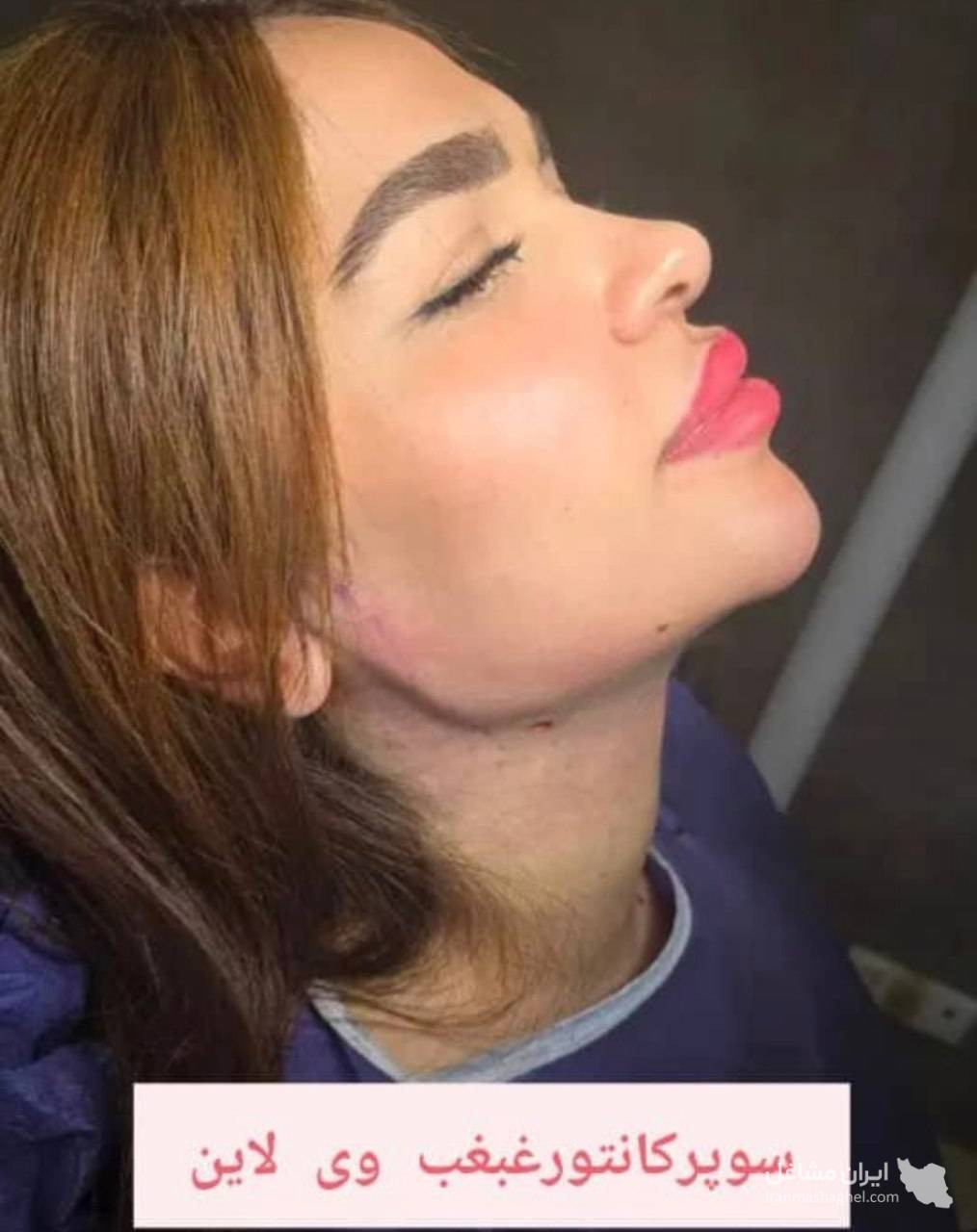 مرکز تخصصی ساکشن غبغب و بوکال فت دکتر وحید عباس نژاد در صادقیه تهران