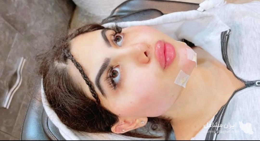 مرکز تخصصی ساکشن غبغب و بوکال فت دکتر وحید عباس نژاد در صادقیه تهران