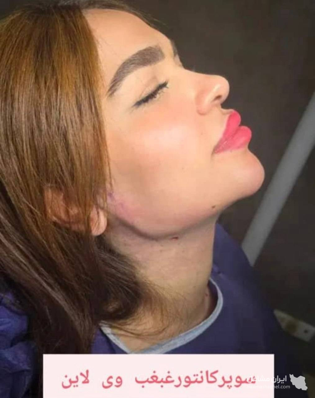مطب زیبایی دکتر وحید عباس نژاد در صادقیه تهران