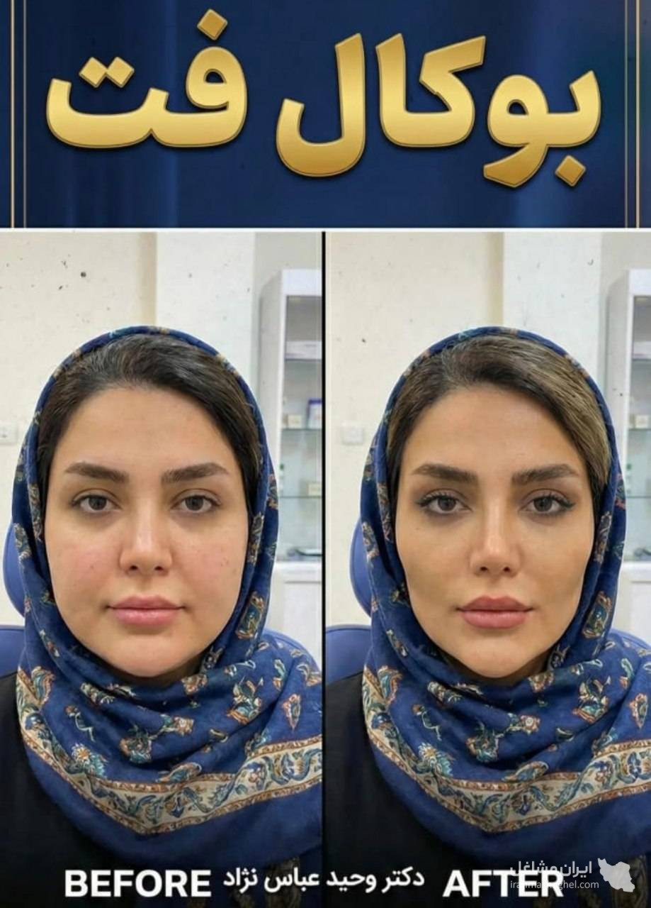 مطب زیبایی دکتر وحید عباس نژاد در صادقیه تهران