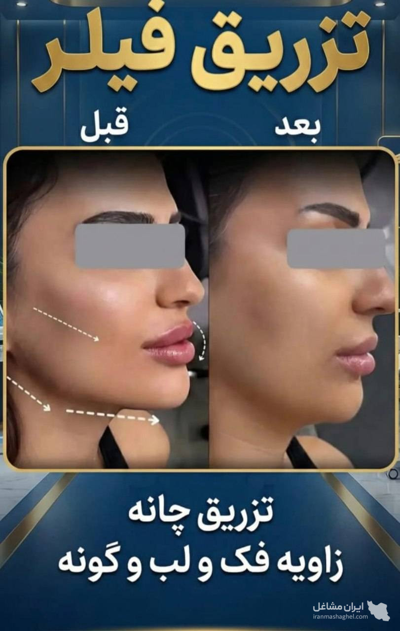 مطب زیبایی دکتر وحید عباس نژاد در صادقیه تهران