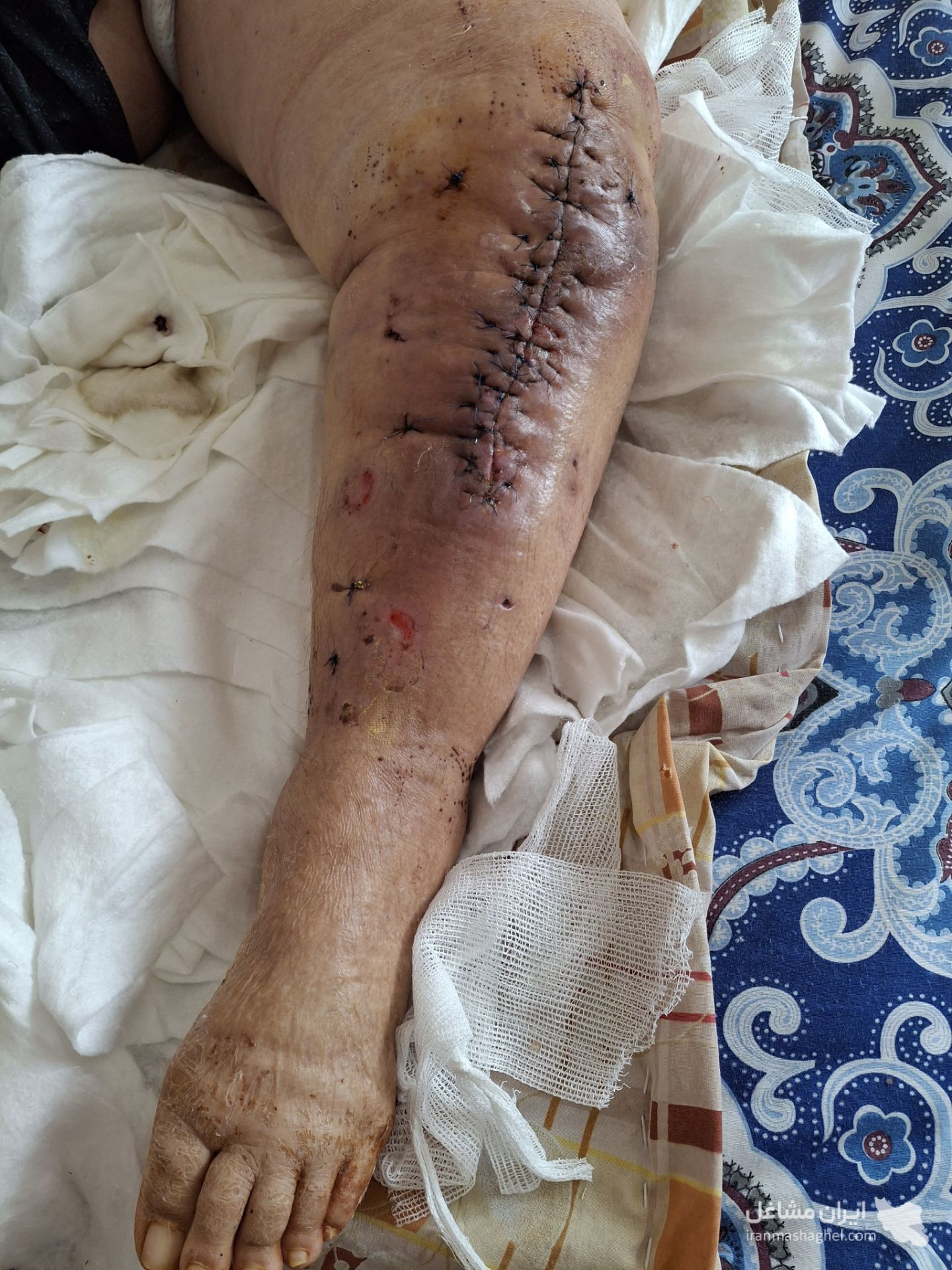 خدمات پزشکی و پرستاری در منزل امیر صحبتی ملایر