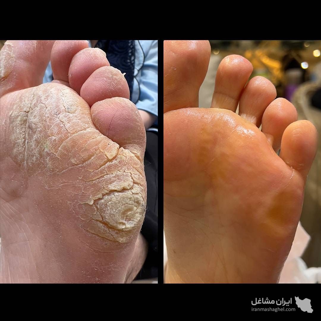 مجموعه سلامت بانوان برمودا ماساژ تخصصی بانوان در قزوین